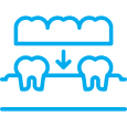 Dental crowns and bridges