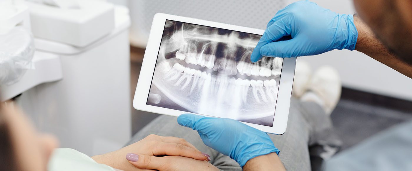 broken tooth digital x-ray on a tablet