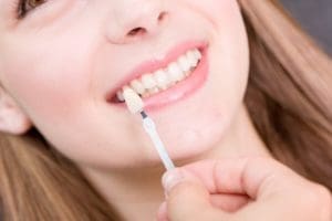 Dental Crowns and Bridges Service in QLD