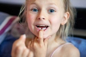 A little girl of 6-7 years old lost the first milk tooth.