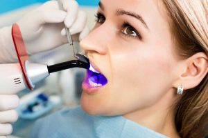 Doctor examines the oral cavity on tooth decay. Caries protection. Tooth decay treatment. Dentist working with dental polymerization lamp in oral cavity.