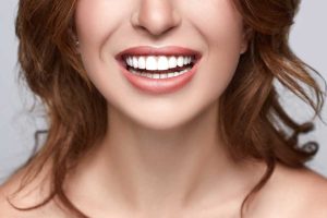 Woman with perfect smile and teeth