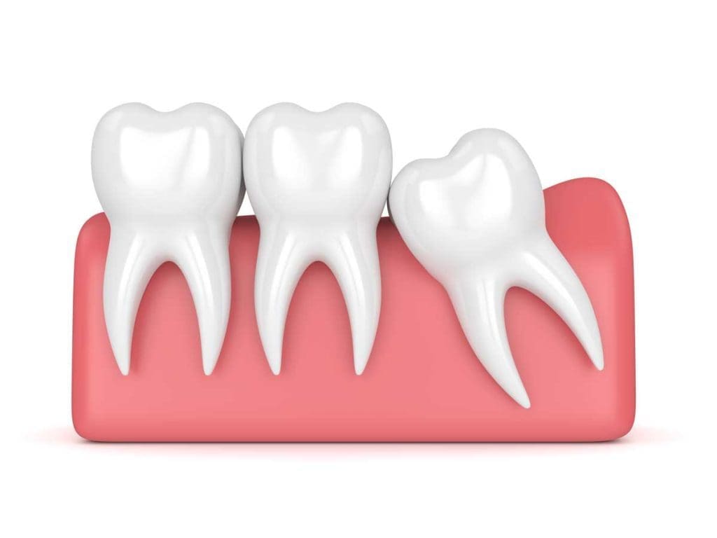 Dental equipment holding an extracted tooth