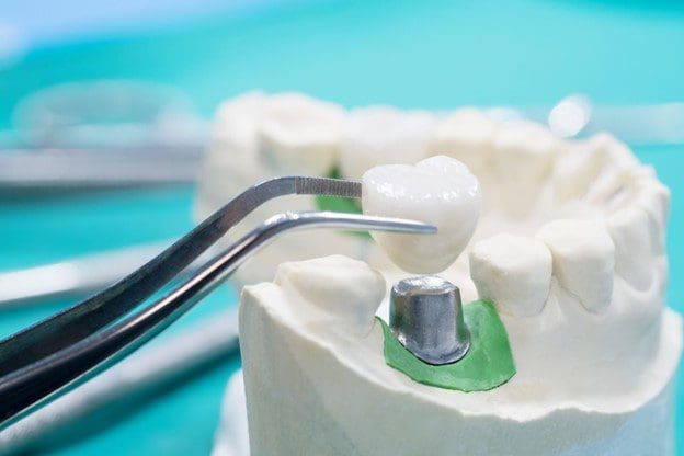 loose dental crown