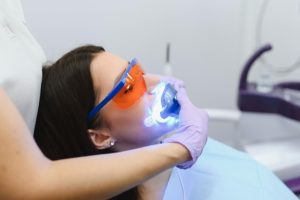 professional teeth whitening in Queensland