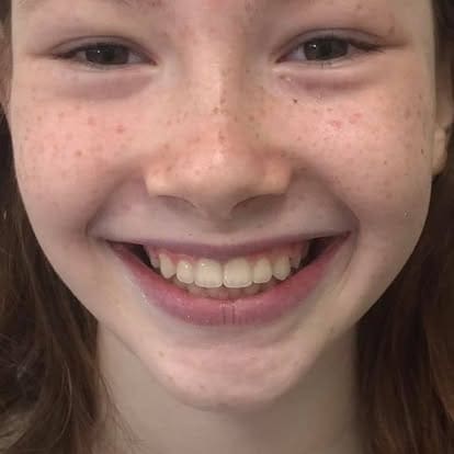 orthodontics smile transformation